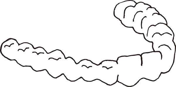 マウスピース型矯正装置（インビザラインファースト）