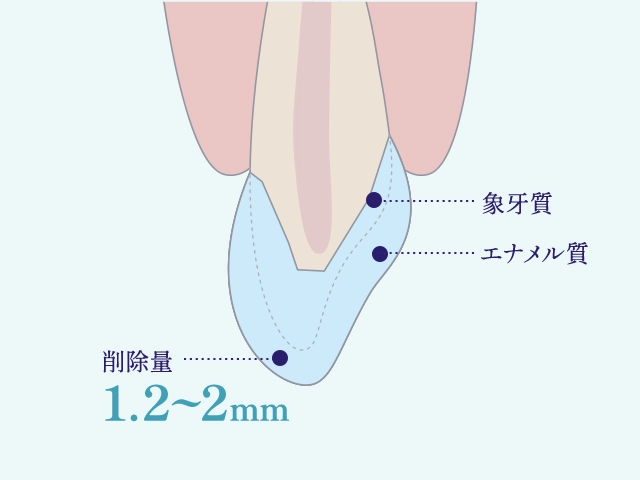 クラウン