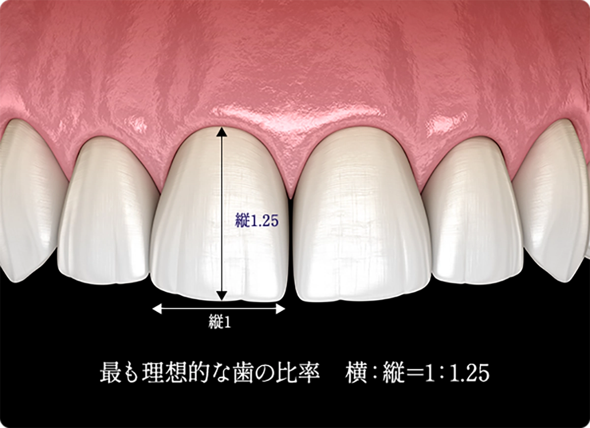 治療アプローチのイメージ